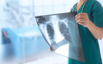Access to Higher Education Diploma (Radiography)